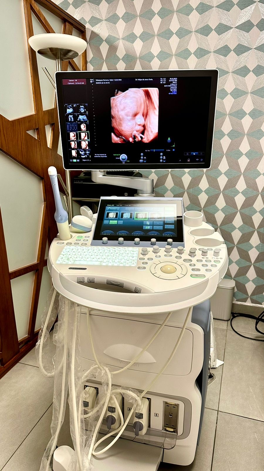 Ultrasonido 5D de Alta Definición